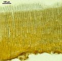 Filamenti peritallici con organi pluriloculari apicali